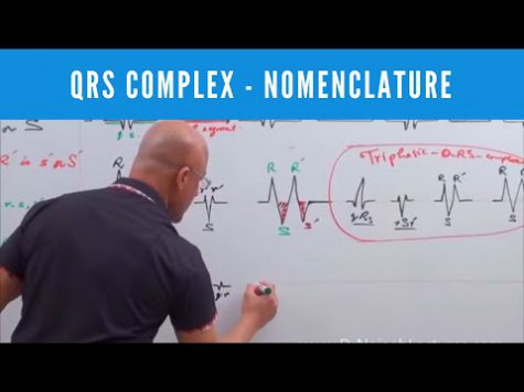 Mastering EKG – QRS Complex – Nomenclature